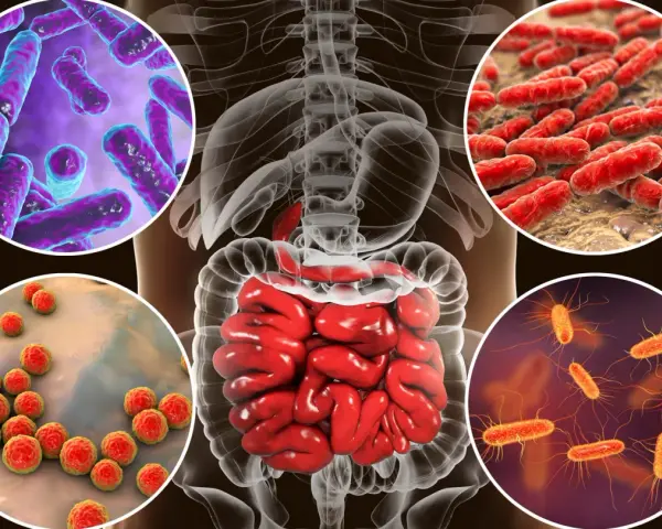 Microorganismos que influyen en la salud intestinal, mostrando bacterias en el intestino humano.